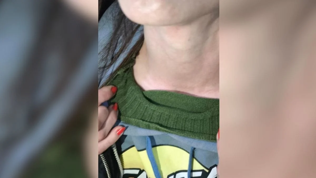 Mulher mostra como ficou a região do pescoço após ser estrangulada (Foto: PM, Divulgação)