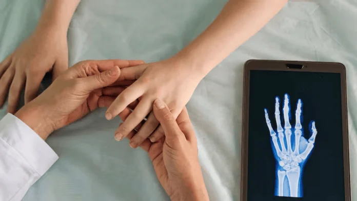 A artrite idiopática juvenil (AIJ) é uma condição que afeta cronicamente as articulações. (Foto: Reprodução/Shutterstock)